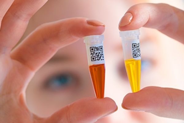 Tests salivaires : l’Adapei de l’Orne déploie le dispositif au sein de ses structures